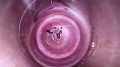 Camera deep inside teen creamy vagina Thumb