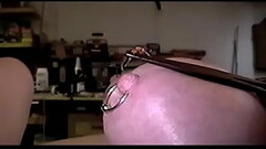 My Wife'_s stung nipple!!! 1 Thumb