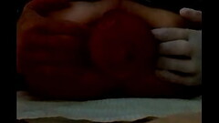 My prolapse Thumb